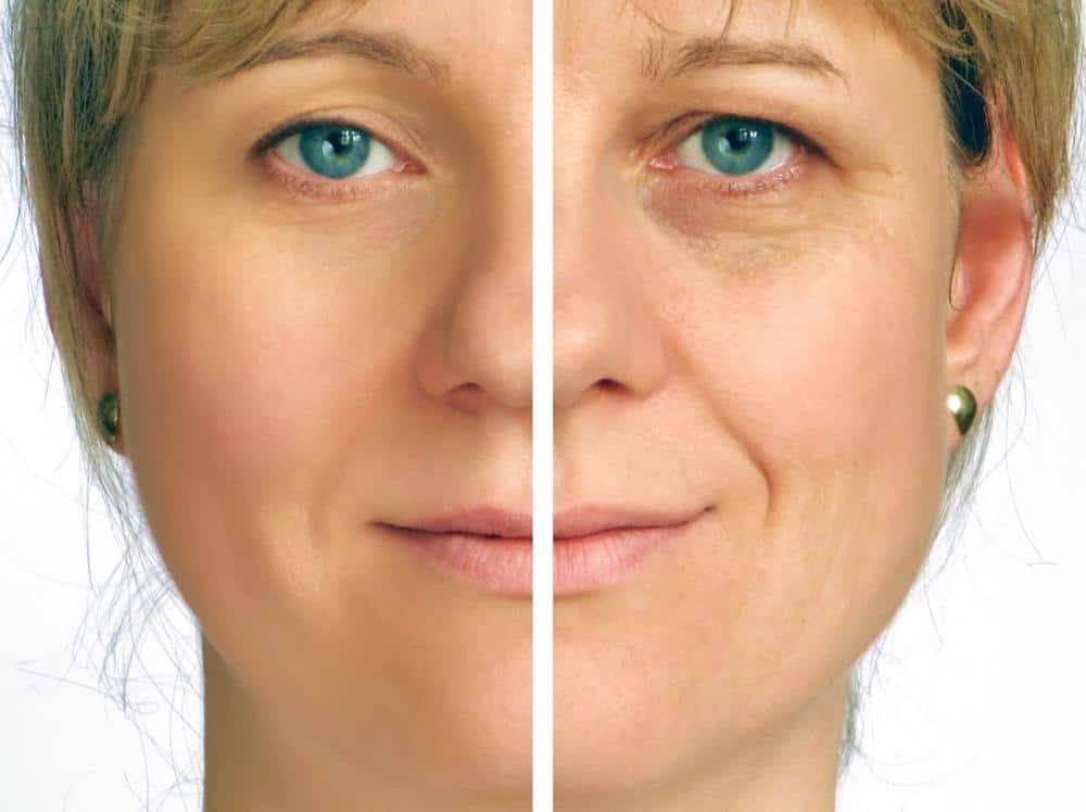 A woman's face is shown split down the middle, with one side appearing youthful and smooth thanks to Juvederm, and the other side showing signs of aging such as wrinkles and sagging skin. The transformation showcases Dr. Karl Hanson's expertise in cosmetic treatments.